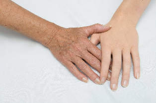 rejuvenecimiento de la piel de las manos