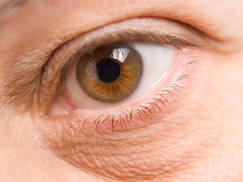 la piel del contorno de los ojos y su rejuvenecimiento con láser